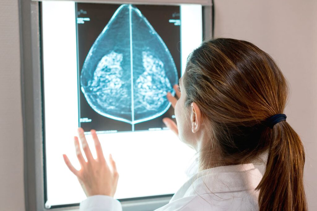 doctor reading mammogram